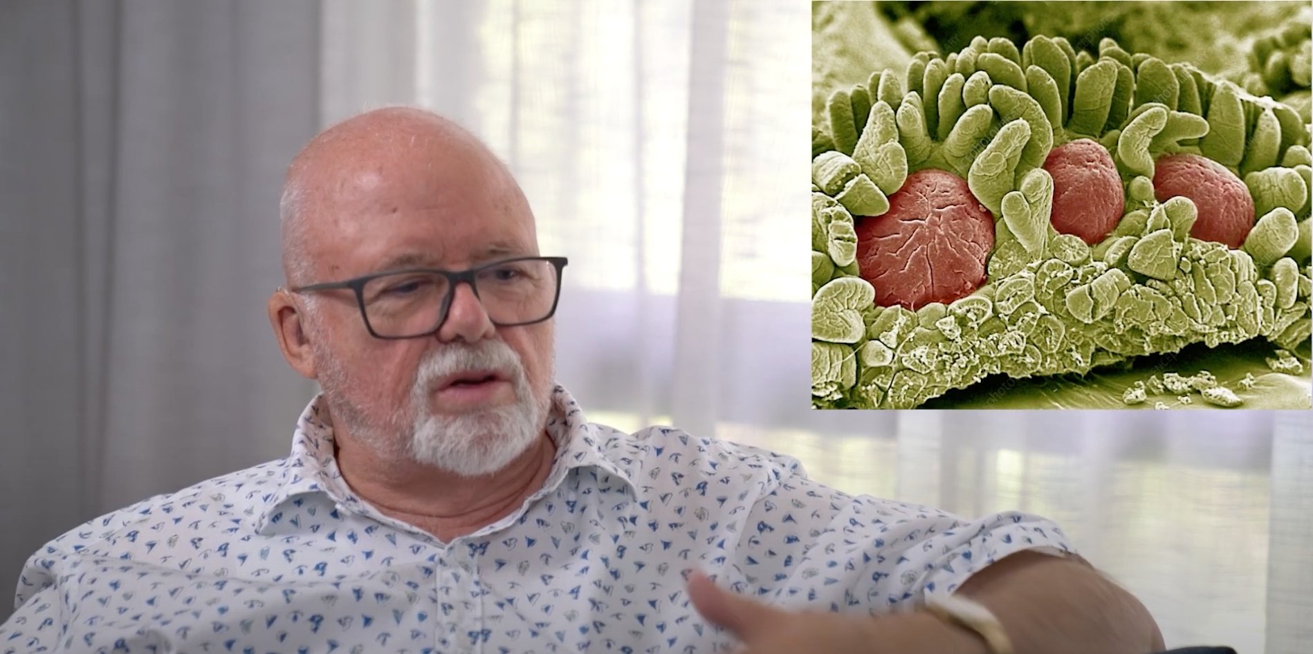 Inflammation of the gut...What we know so far!